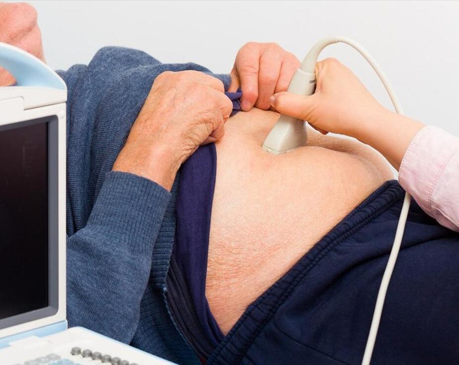 结直肠癌一般发病年龄,结直肠癌的诱因及病因