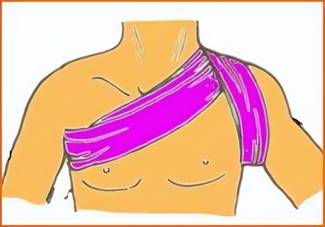 肩周炎肩膀疼一招立刻解决肩痛,肩周炎是什么原因造成肩膀痛