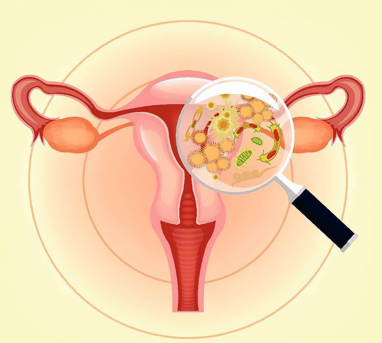 为什么月经结束后，会出现“褐色分泌物”？如果你也有，别忽略了