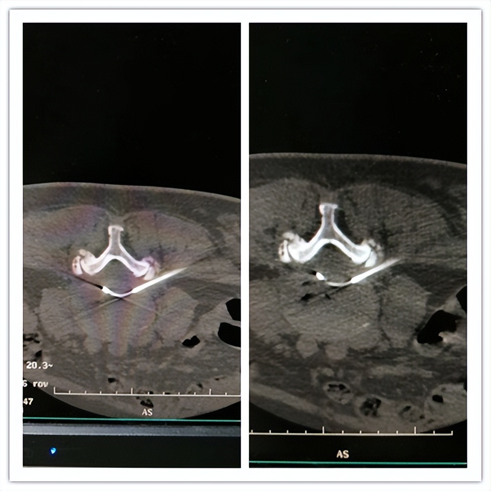 嘉善人民医院疼痛科专家,嘉善第一人民医院中医内科