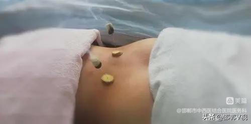 邯郸市中西医结合医院有哪些,邯郸市第一医院中西医结合科门诊