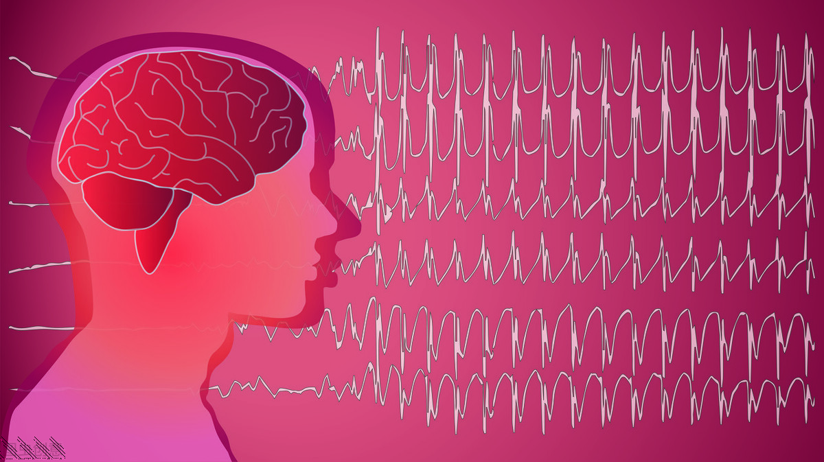 丙戊酸钠与左乙拉西坦联用,丙戊酸和左乙拉西坦哪个副作用小