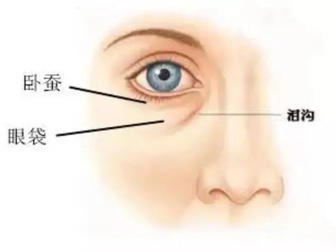 脾虚眼袋改善方法图谱,脾虚型眼袋怎么调理