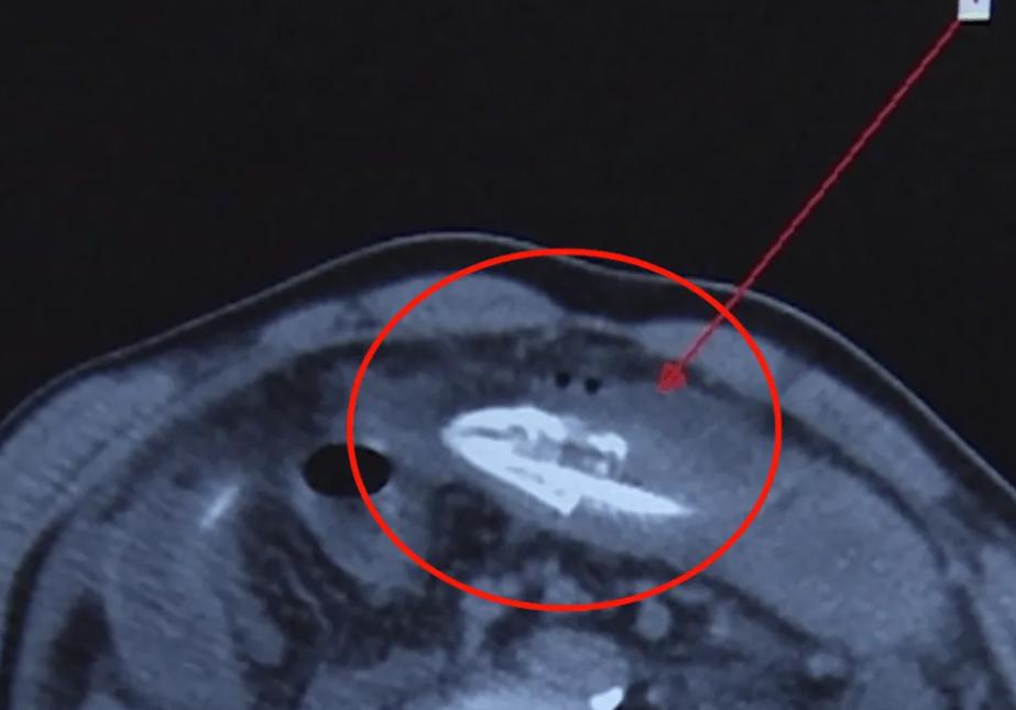 蛇吃毒蛇为什么不会中毒,蛇吃生肉为什么不会得病