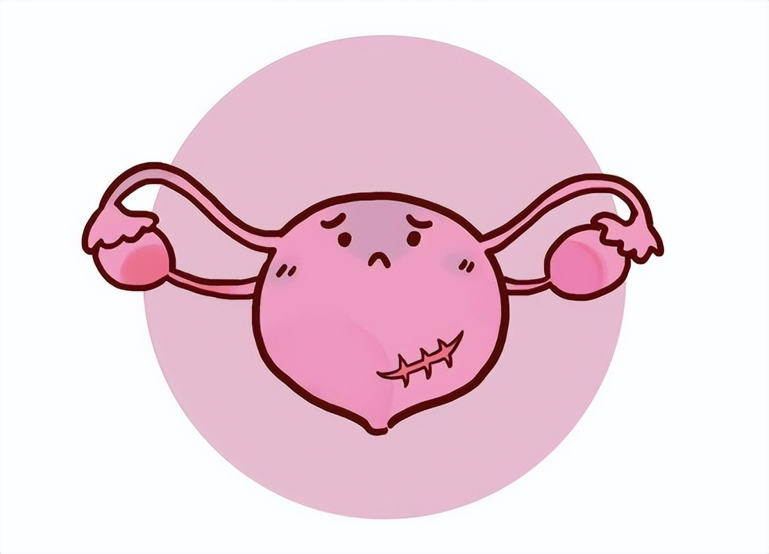 子宫性不孕要如何诊断,查不孕不育查出宫颈病变