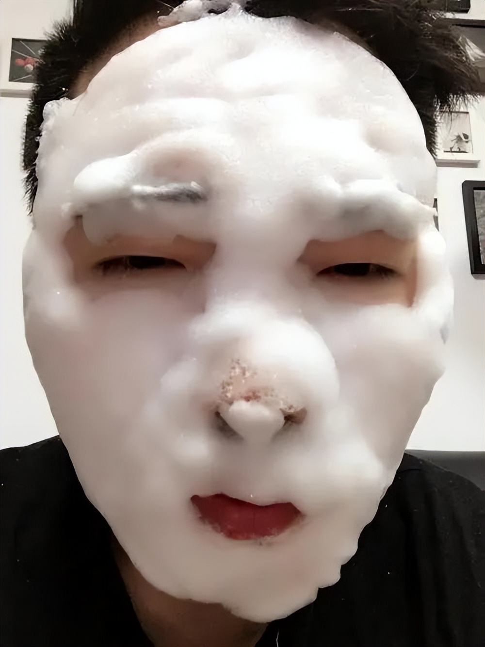 美容院护肤去黑头正常价格,小气泡去黑头美容仪器