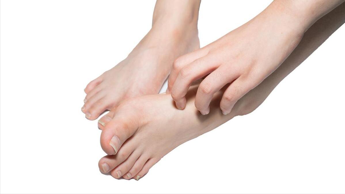 脚后跟起皮粗糙干裂涂维生素e,脚后跟干裂吃维生素b12行吗