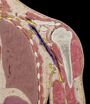 肩膀总是咔咔响？你的肩关节弹响，可能是这些原因