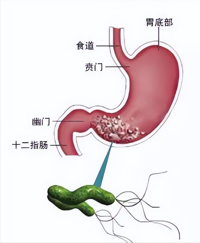乙肝患者血小板低是什么原因,乙肝患者血小板减少怎么治疗