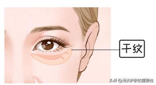 眼纹明显皮肤松弛显老,眼纹显老怎么办