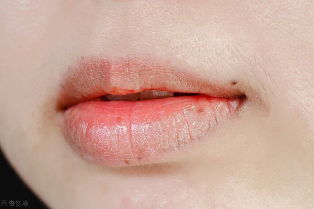 口干口渴喝水不解渴中医辨证,夜间口干咽干要警惕三种疾病