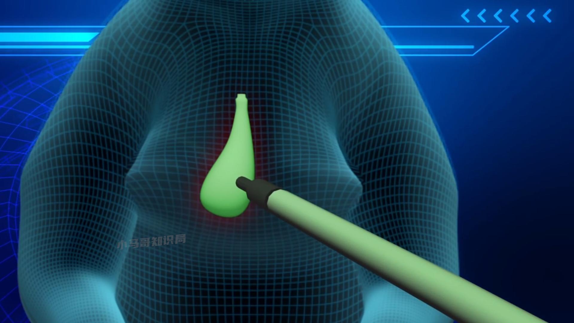 活着插管取胆,老了分解卖钱,活熊取胆那么残忍,为什么不禁止?