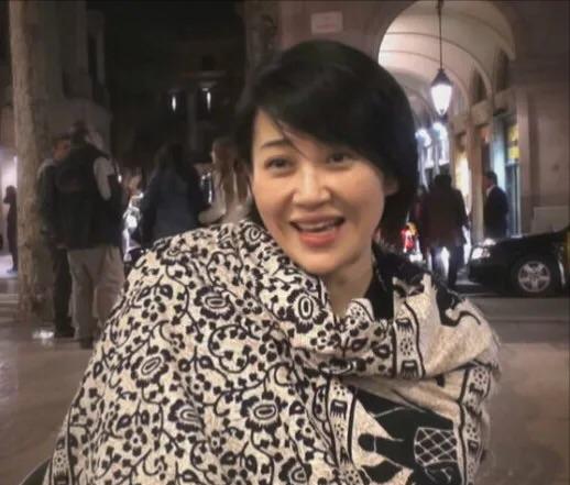 面部衰老皱纹解剖图,面部皱纹衰老对比图