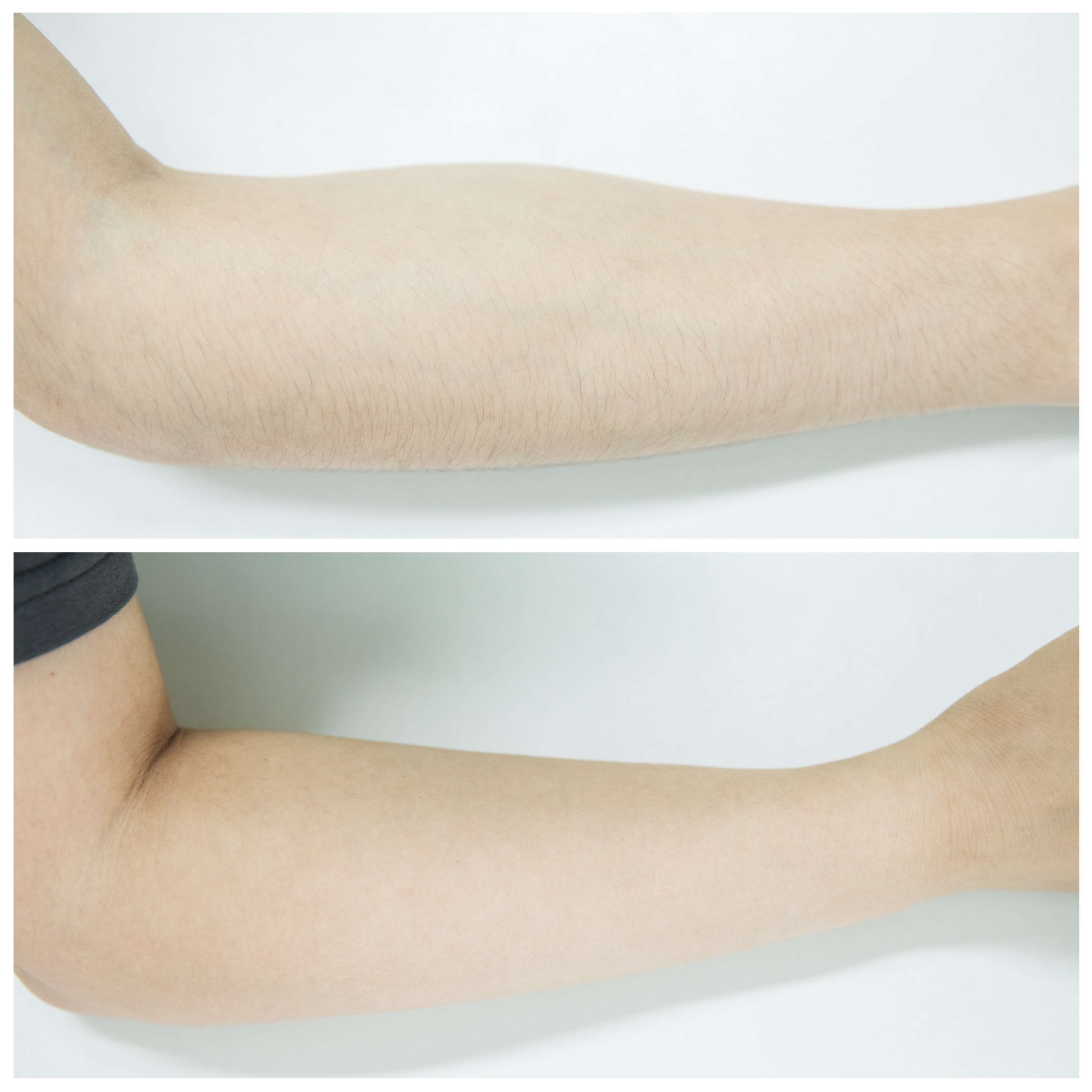 脱毛仪到底是黑科技还是智商税,脱毛仪是智商税还是高科技神器