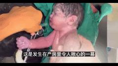 婴儿发生心跳呼吸骤停时,婴儿刚出生心脏就出现骤停