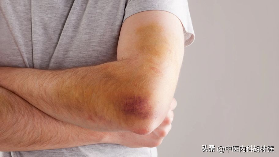 片仔癀黄金,中药片仔癀的功效及价格