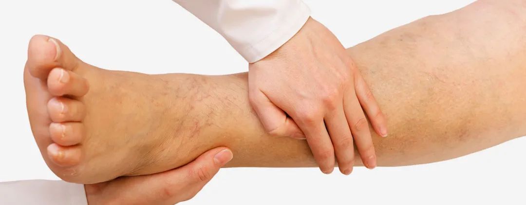 足部手术后肿胀如何处理,足部手术后肿胀发紫怎么消除