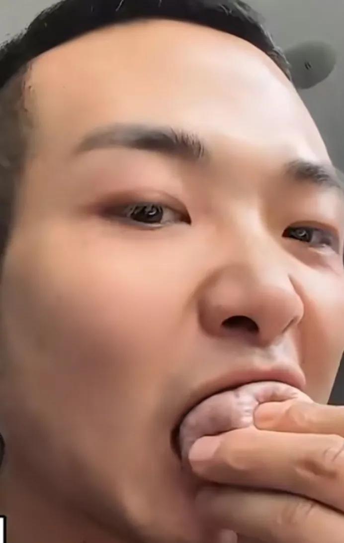 每天嚼5包槟榔连续吃10年,小伙一天吃一包槟榔恶心想吐