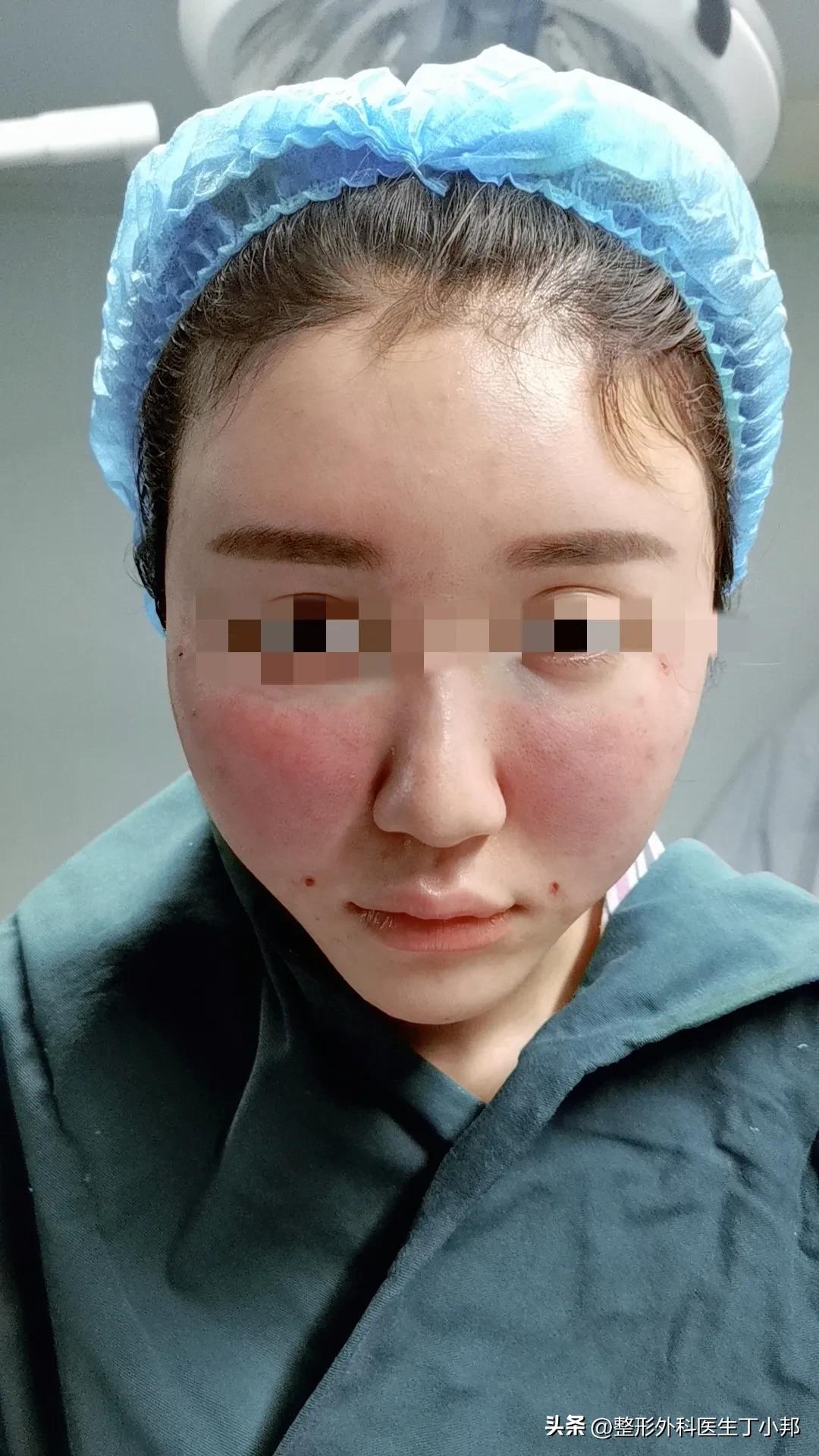 一个小姑娘毁容,一个女的毁容后才知道是救了自己