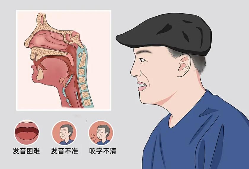 大脑开始萎缩有什么症状,大脑萎缩会有哪些反应