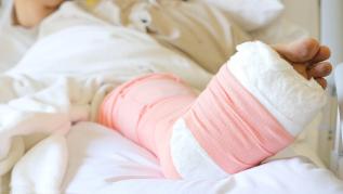 早期骨髓炎不严重就不治,骨头没长好出现骨髓炎