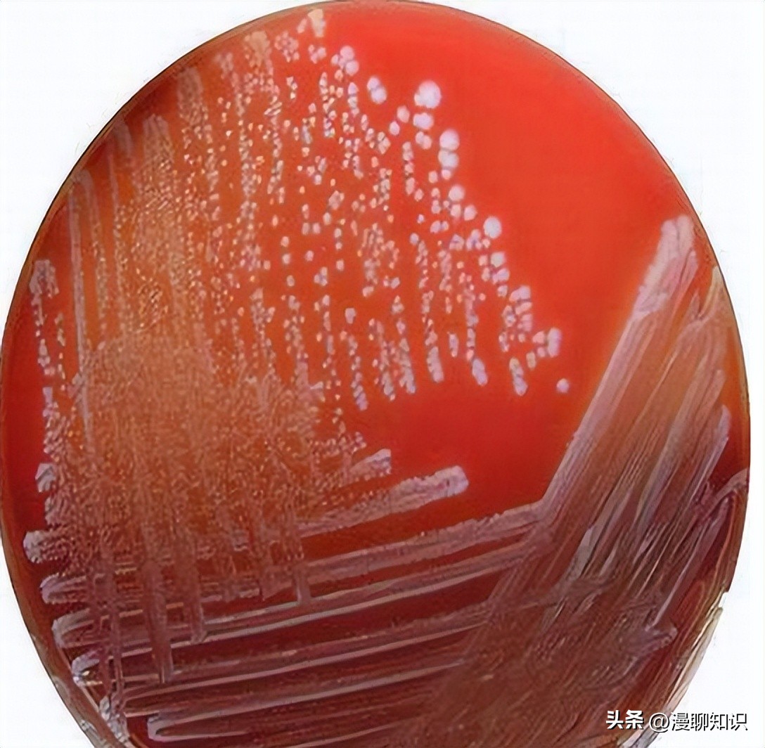 牦牛是高山地区牛的独特品种，肉质鲜嫩，但却饱受葡萄球菌的侵害