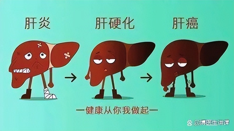 乙肝患者不要过度恐慌,发现乙肝却无症状如何对待