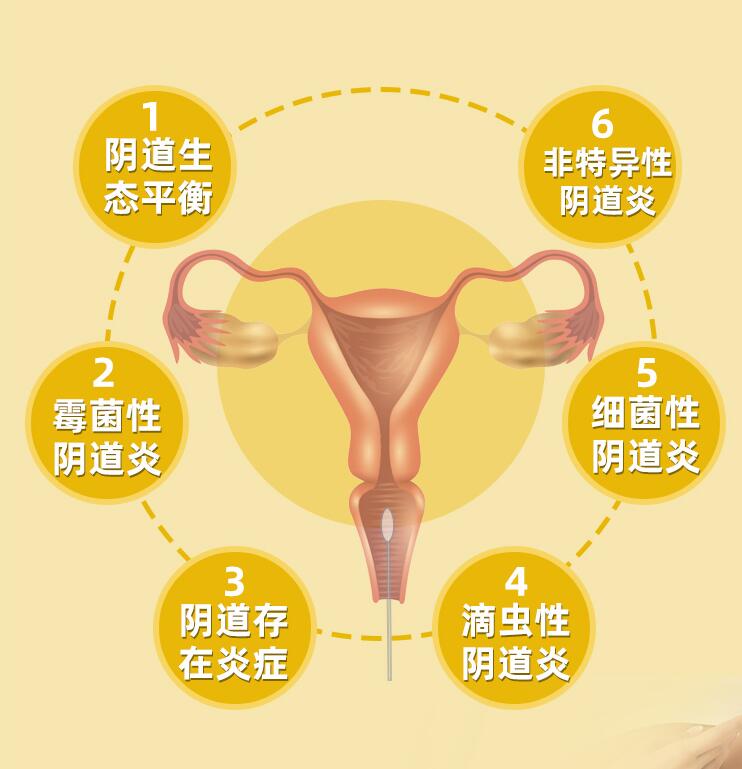 女性有妇科病怎么查能查得彻底,判断妇科病最简单方法