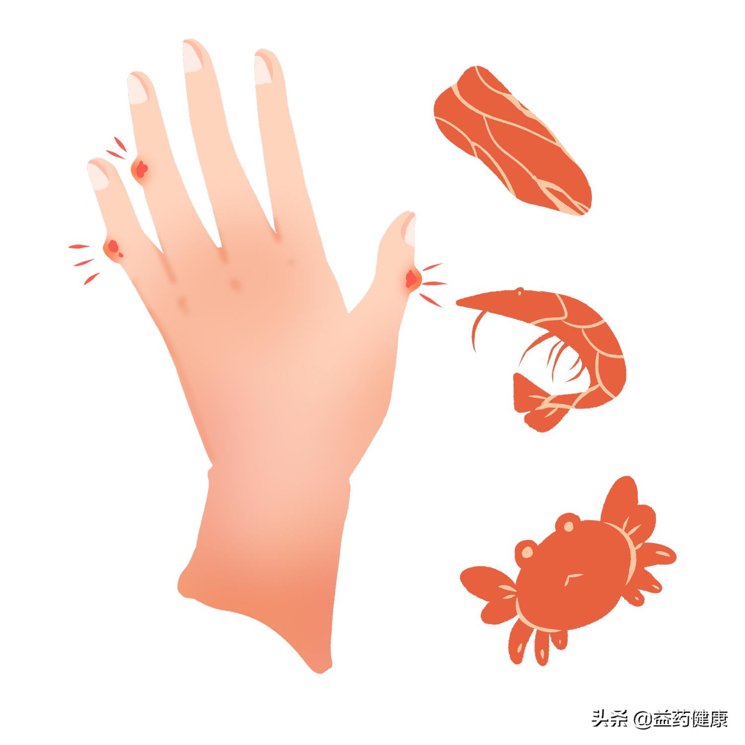 痛风患者吃非布司他记住这4点，掌握用药注意事项，降尿酸更安全