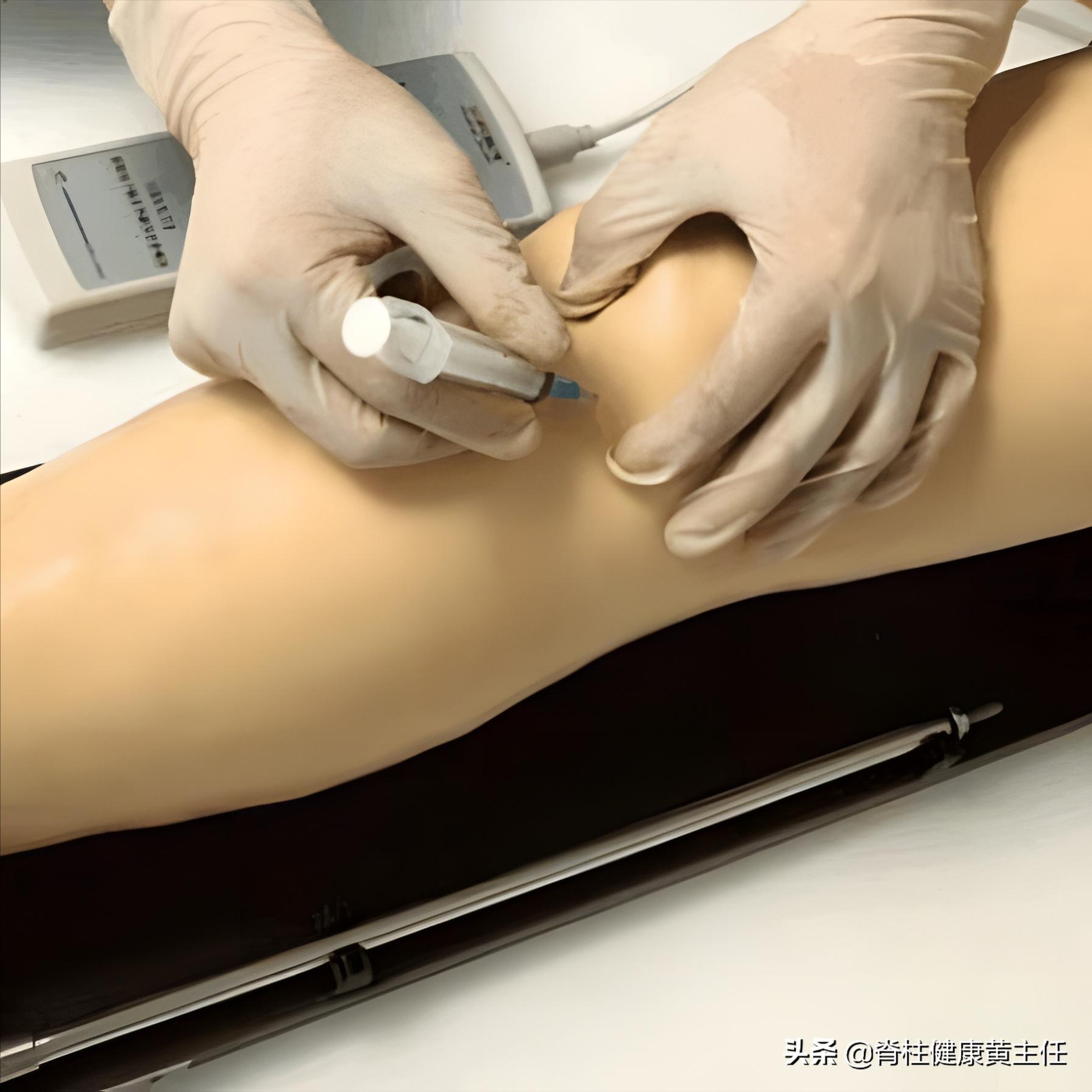 膝关节有积液是怎么回事?积液要抽出来吗?告知您