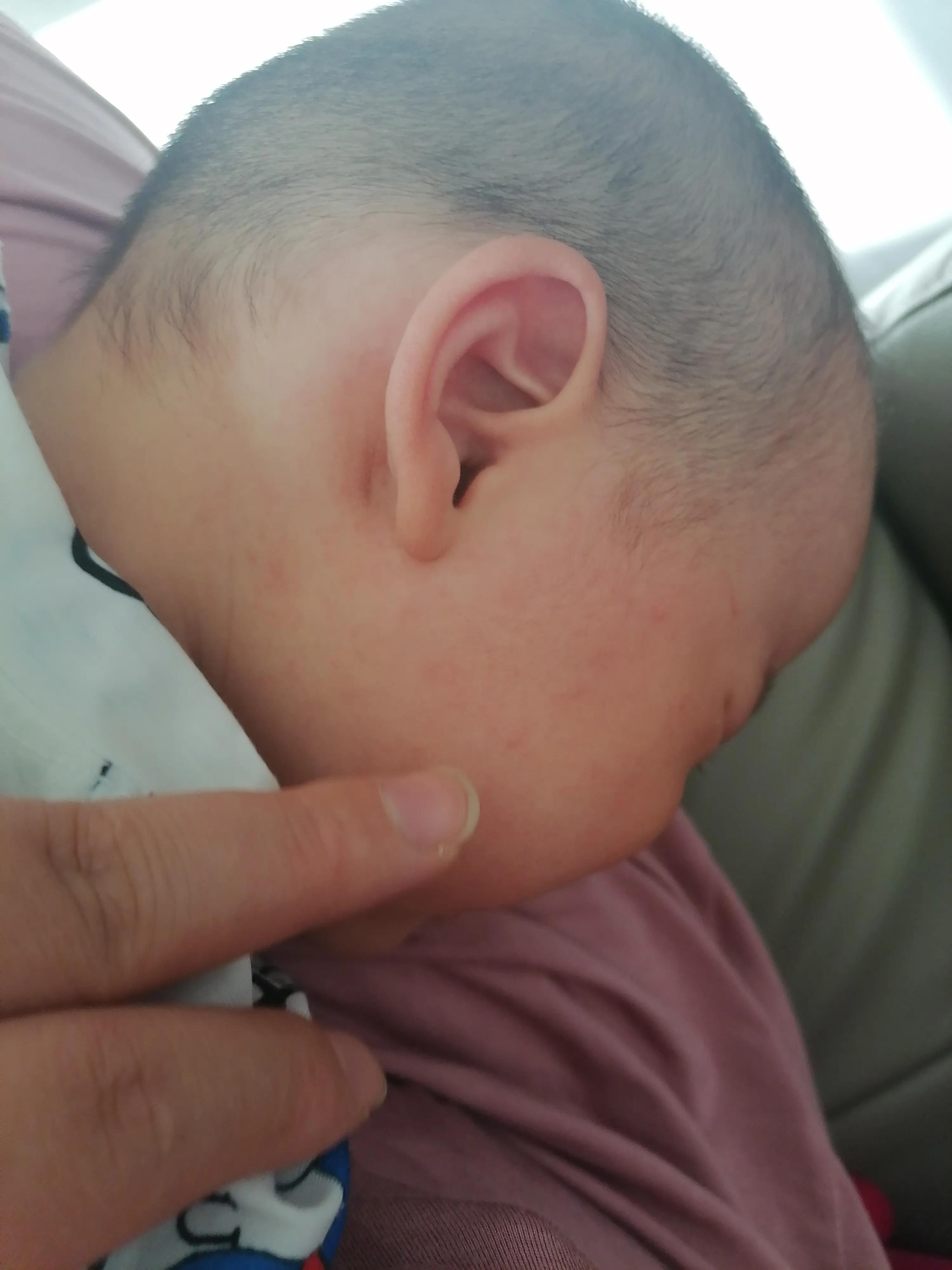 宝宝急疹一般几天痊愈,9个月宝宝幼儿急疹高热怎么喂药