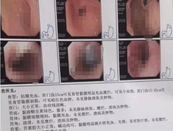 26岁女孩把50cm“仙女管”塞入体内，视频曝光：病态欲望正在蔓延