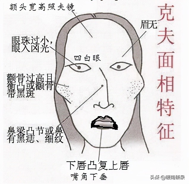 女人颧骨有痣道家,女人颧骨长痣寓意好吗