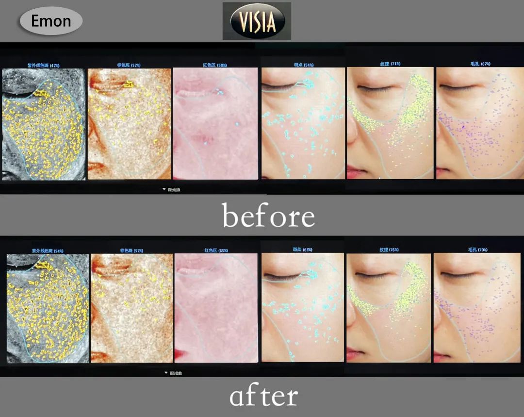 美肌试颜室‖直播见证，4周院线护肤的逆袭之路