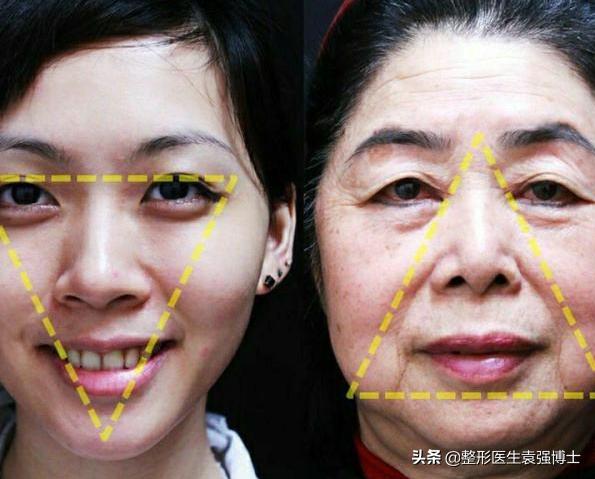 30岁脸开始发腮,40岁后脸好像没那么方了