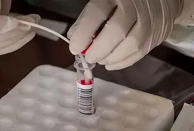 戳舌头、刮牙齿、捅喉咙，哪个才是正确的核酸采样方法？不小心碰到核酸管里的红色液体，有影响吗？