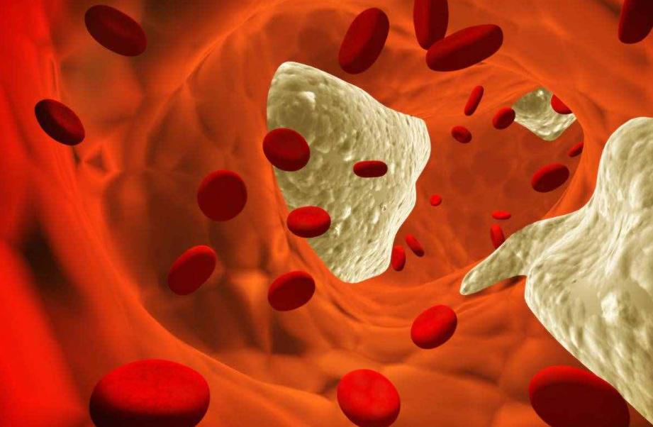 46岁的男人体重标准是正常的,男性55岁左右体重控制在多少合适