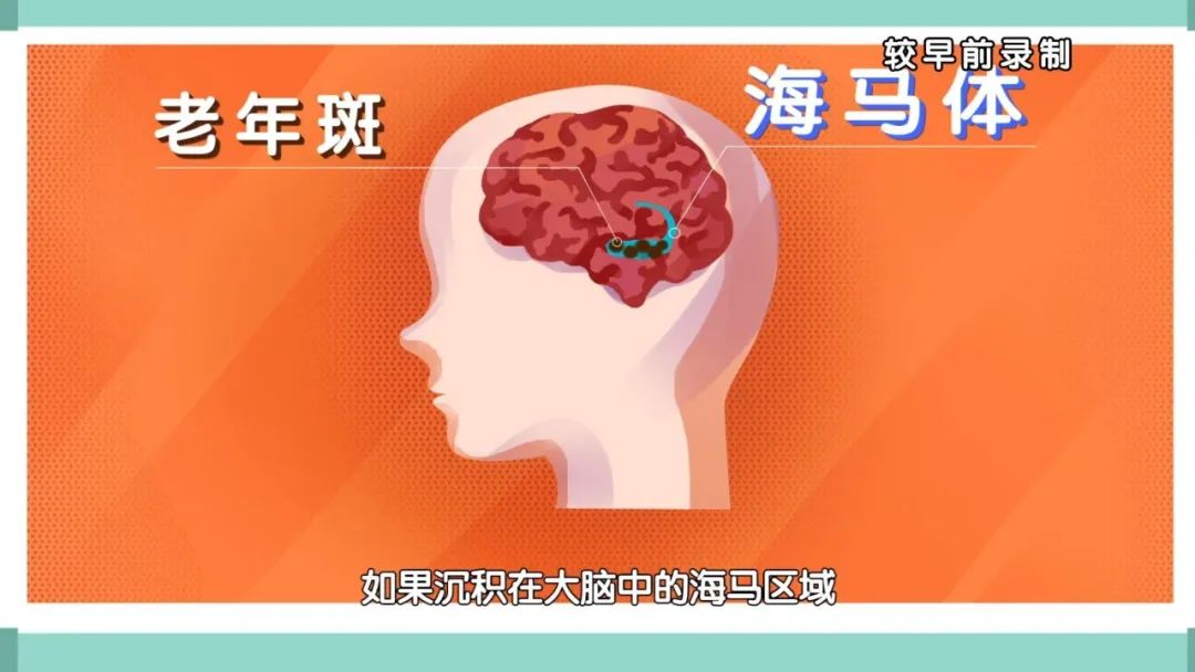 吃核桃能预防老年痴呆,常吃核桃能够延缓大脑的衰老吗