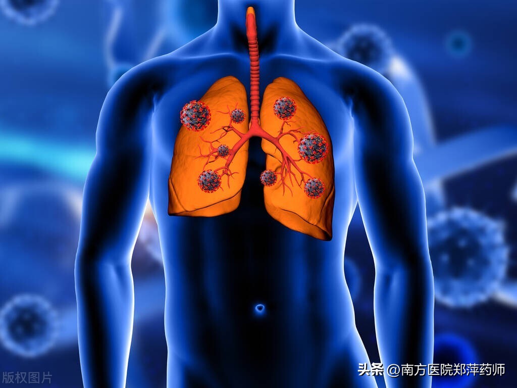 哮喘和慢阻肺（COPD）患者，新冠病毒流行期，了解这些关心的问题