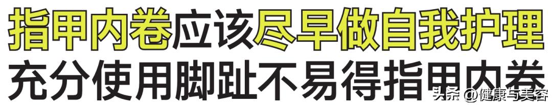 指甲卷曲内卷,指甲卷曲用什么药