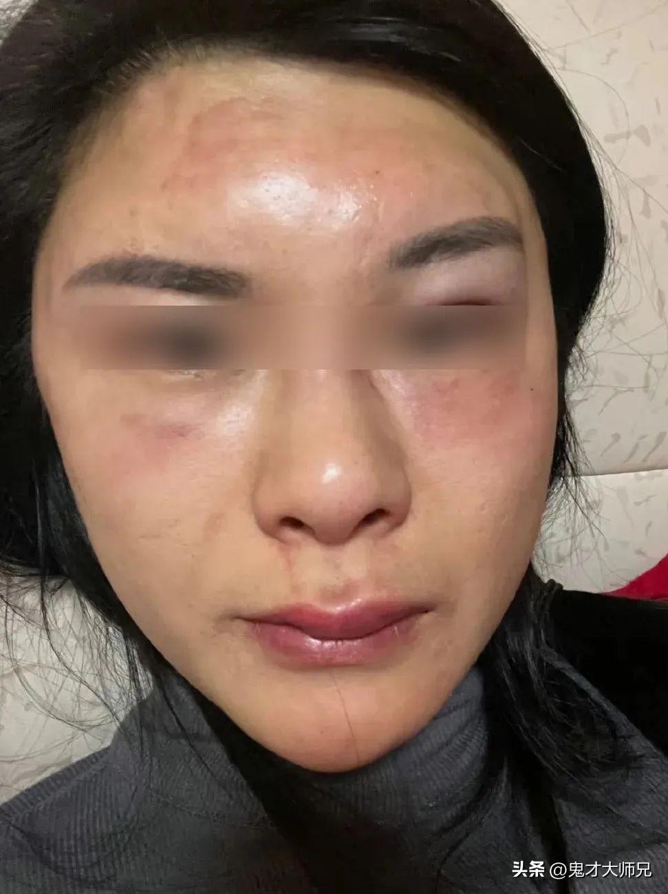 砍杀柯基威胁女子彩礼返还,砍杀柯基事件女子离婚了吗