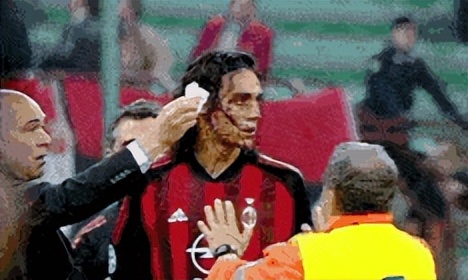 你可知足坛中曾有过这样一名后卫，从未伤过人，受伤的永远是自己