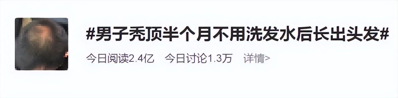 只用清水洗头有助于生发吗,长时间用清水洗头会怎样