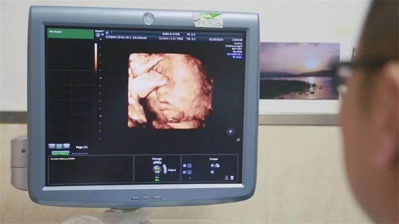 妈妈将子宫移植给孩子,2015年43岁母亲将子宫移植给女儿