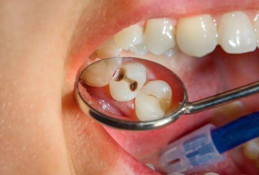 牙科恐惧症如何缓解,牙科焦虑症和牙科畏惧症