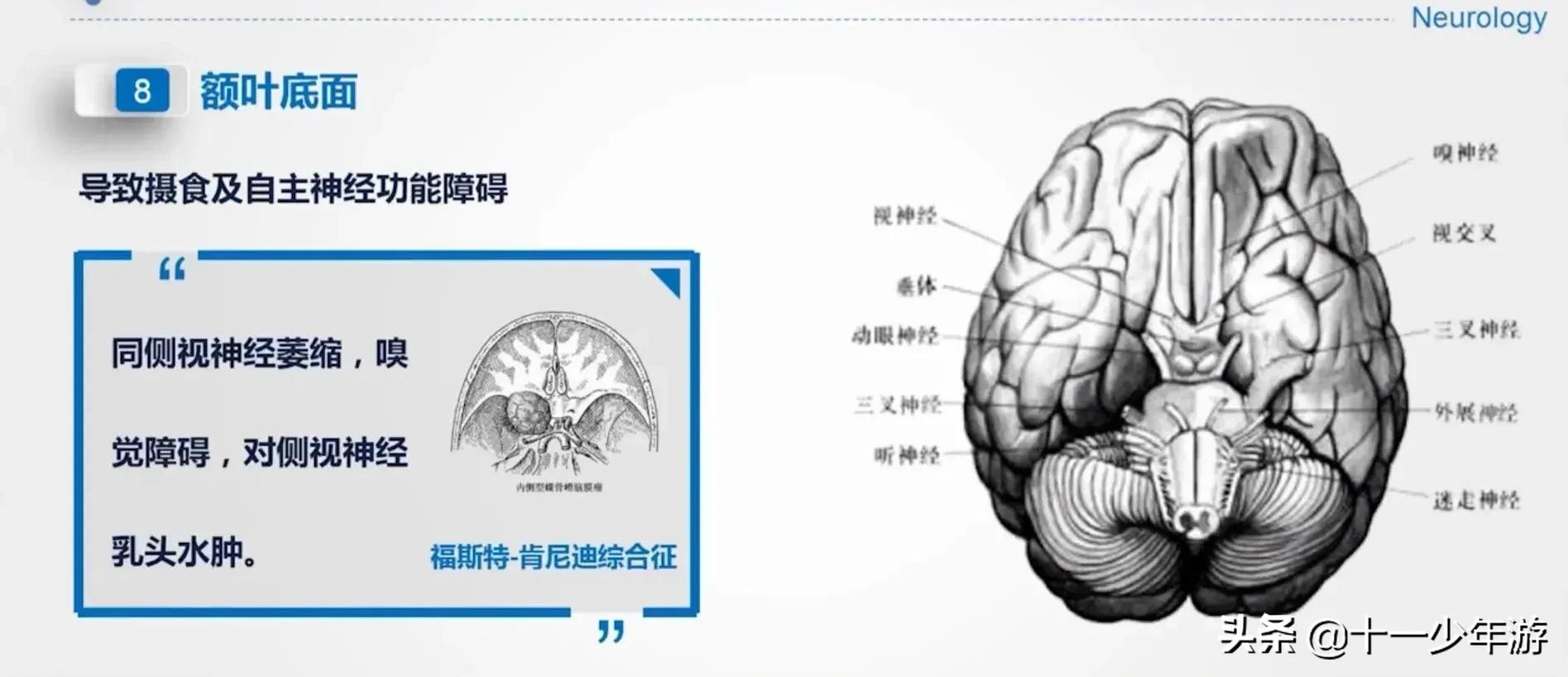 大脑的结构解剖示意图,大脑镰下疝解剖结构