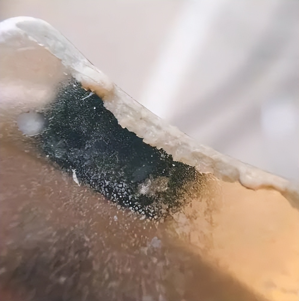 美容院护肤去黑头正常价格,小气泡去黑头美容仪器