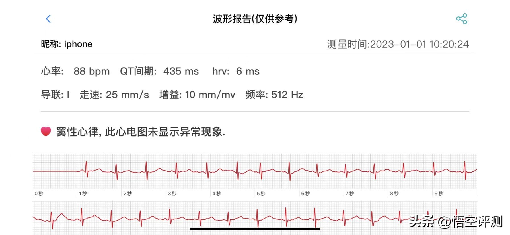 didoe55智能手表靠谱吗,智能手表健康管理哪个最有用