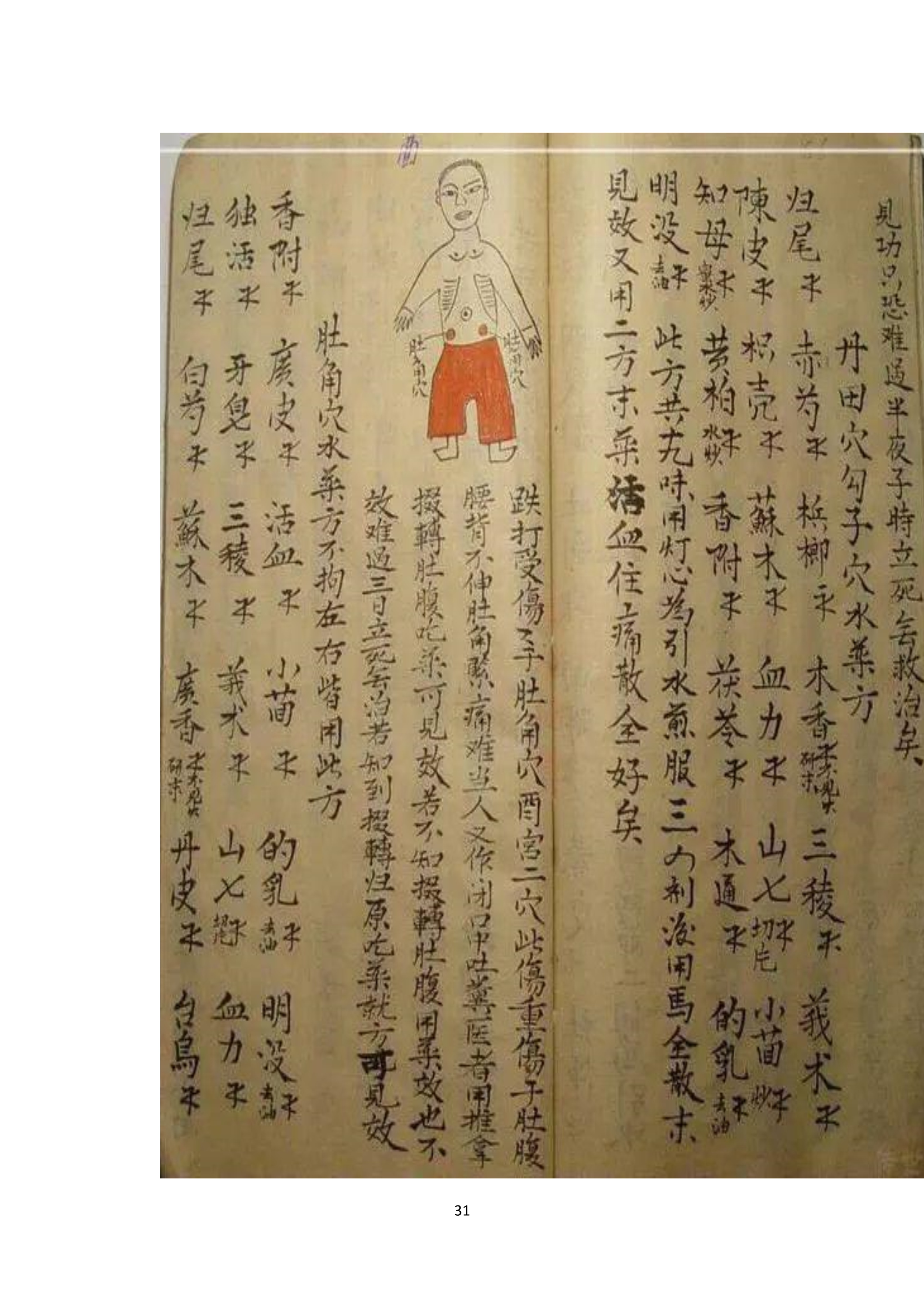 中医古书籍清代带图且内容非常好的手抄跌打损伤良方