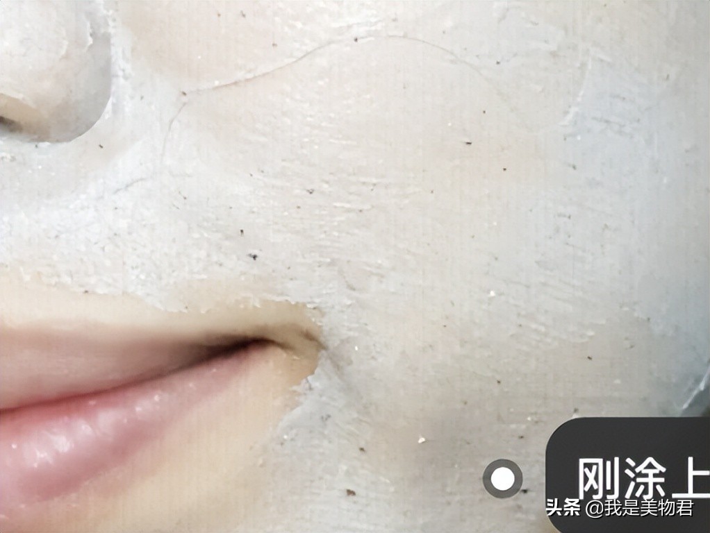 毛孔堵塞闭口粉刺怎么去除最有效,毛孔堵塞闭口粉刺怎么消除